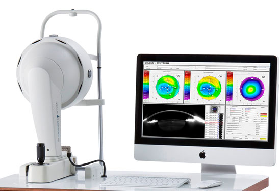PENTACAM眼前節(jié)分析儀